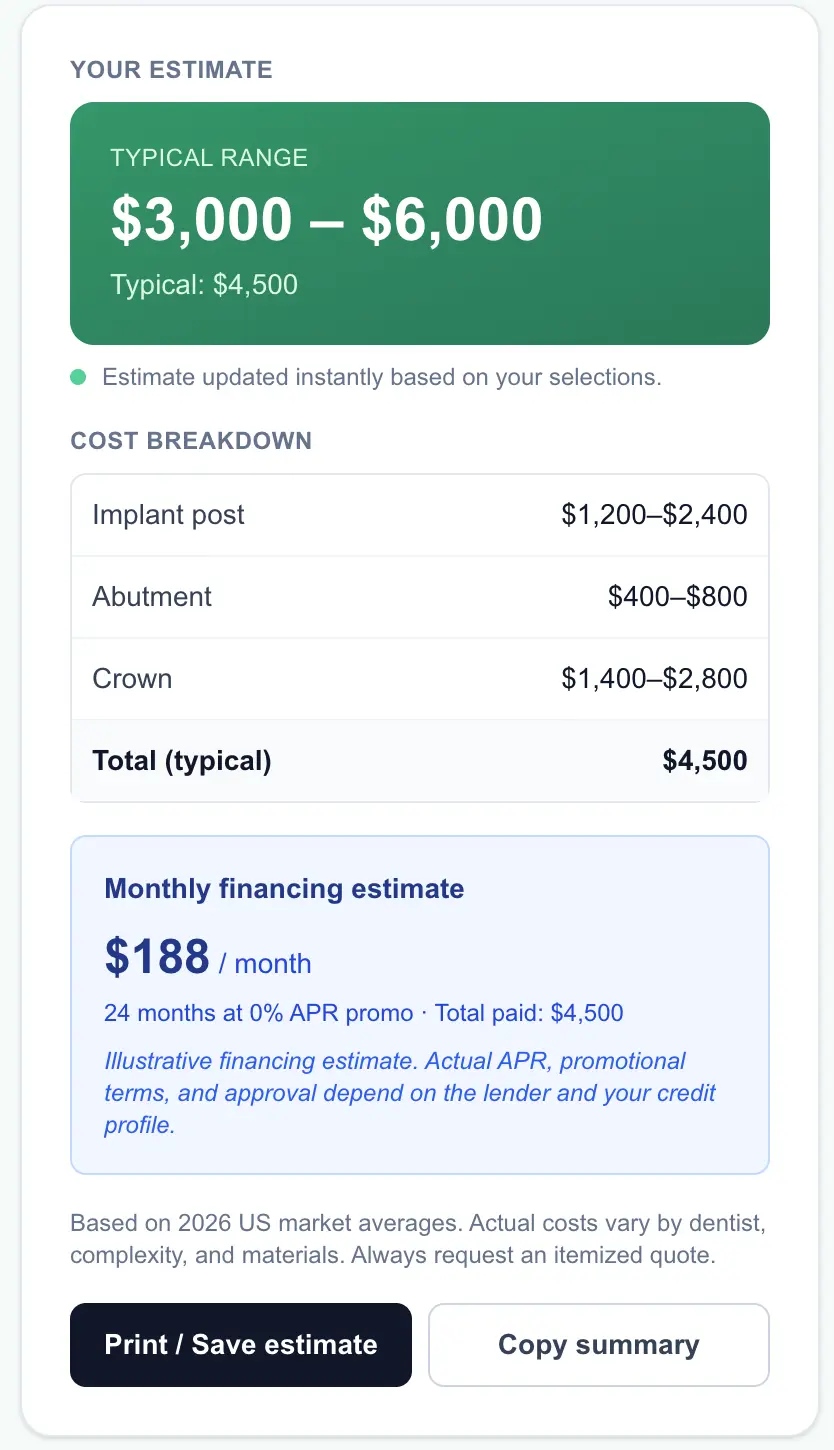 Dental implant calculator results panel showing a real-time estimate